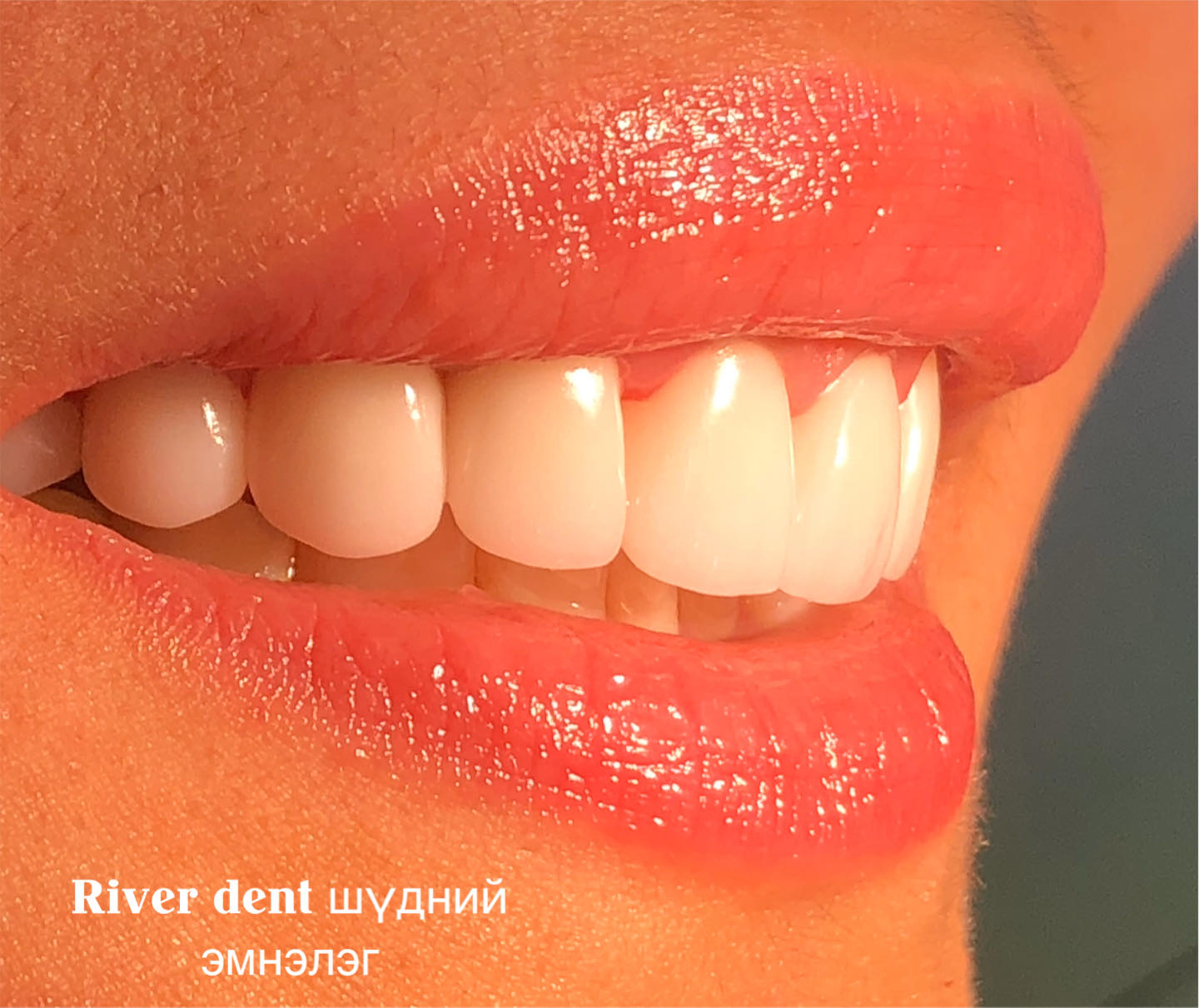 River Dent Гэр бүлийн шүдний эмнэлэг