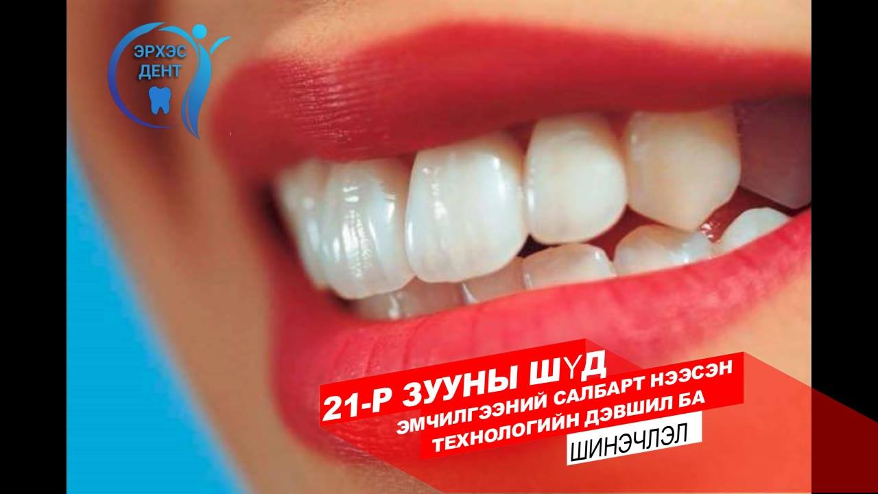 ШҮД